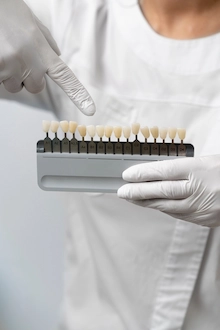 Dental Implant Smile