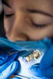 Extraction Consultation